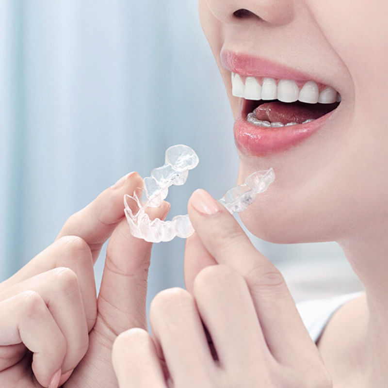 特徴01タイトル